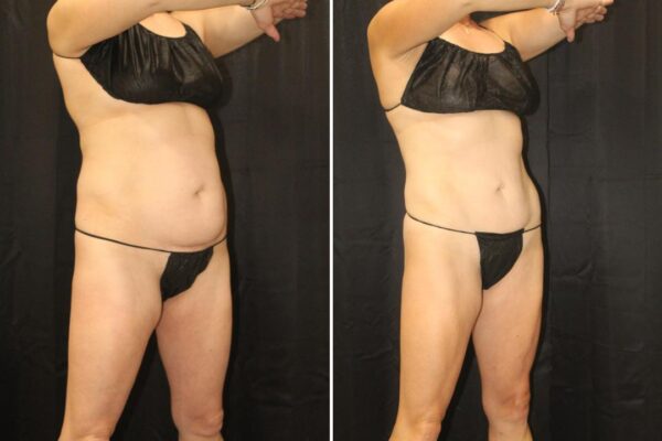 angled_female_ba_with_line