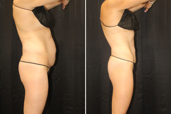 angled_female_ba_with_line