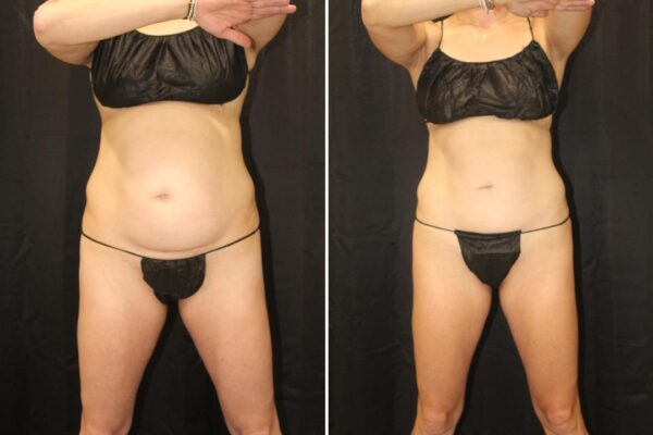 female_fullbody_ba_with_line